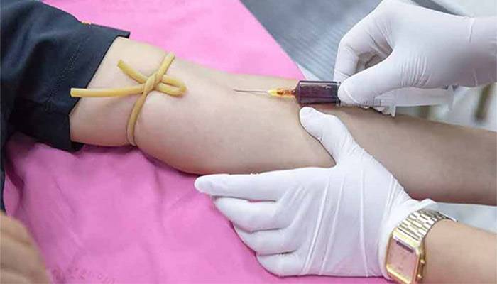 گولڈن بلڈ نایاب کیوں ہے؟