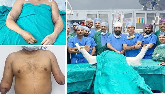 انڈیا: گنگارام اسپتال کا کارنامہ، بازوؤں سے محروم شخص کو نئے بازو لگا دیے