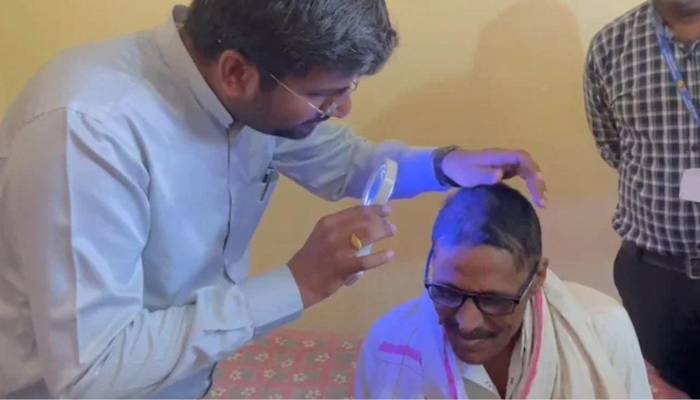 بھارت میں درجنوں افراد راتوں رات گنجے، علاقے میں خوف وہراس