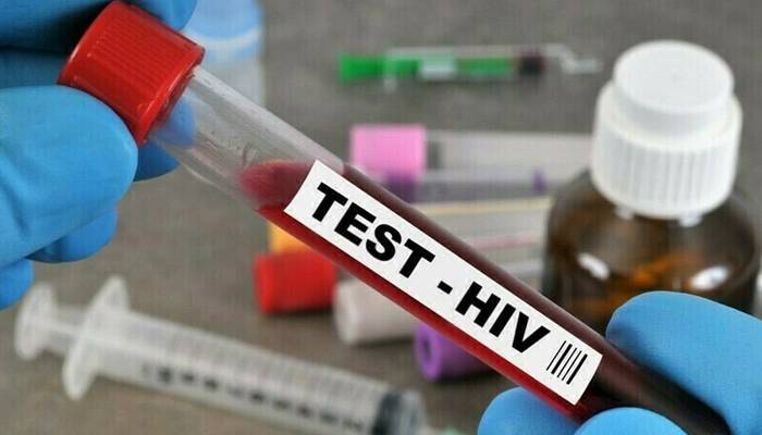 تونسہ:3ماہ کےدوران100سے زائد افراد میں HIVکی تصدیق