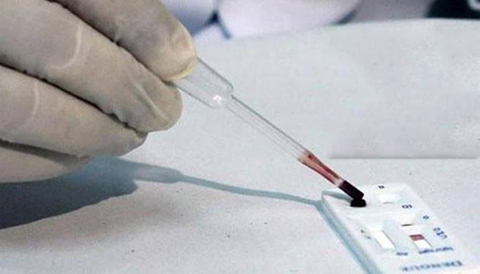 ملتان میں خطرے کی گھنٹی بج گئی،مریض میں کانگو وائرس کی تصدیق