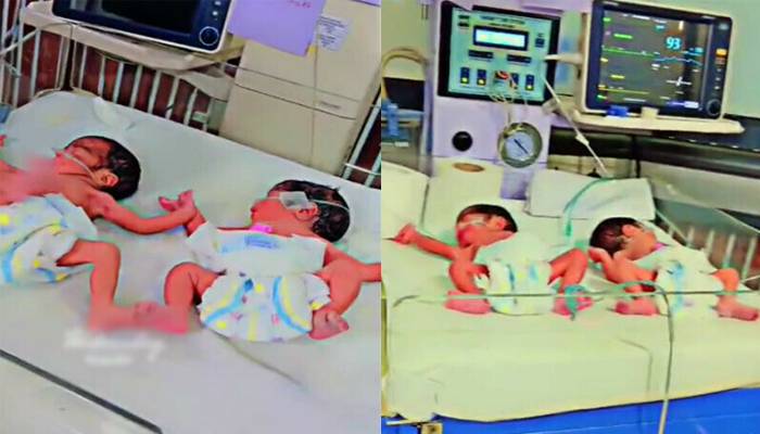 3بچوں کو جنم دینے والی خاتون کے ہاں دوبارہ 5بچوں کی پیدائش