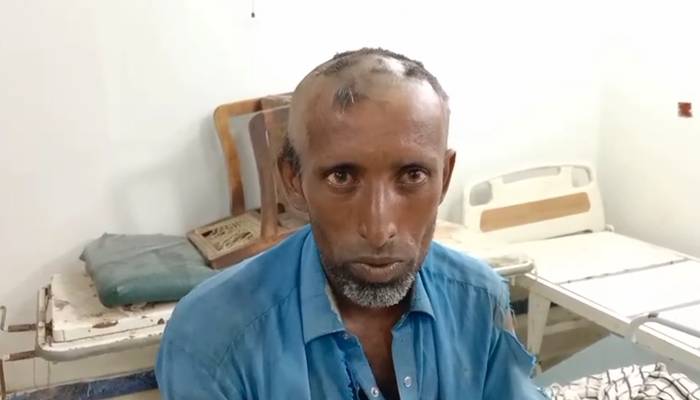 اراضی تنازع پربااثرافراد کا مزدور پر تشدد،سرکےبال،مونچھیں مونڈ ڈالیں