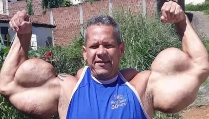 ’ریئل پوپائے‘ کے نام سے مشہور برازیلین باڈی بلڈرانتقال کر گئے