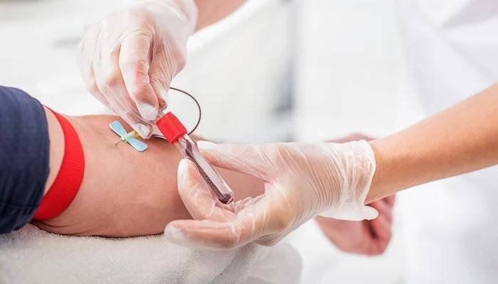 کیا خون کا ٹیسٹ یا عطیہ دینے سے روزہ ٹوٹ جاتا ہے؟