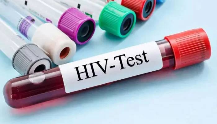 ملک میں ایچ آئی وی ایڈز کے مریضوں کی تعداد میں حیران کن اضافہ