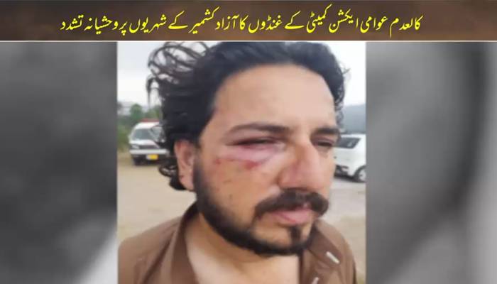 کالعدم عوامی ایکشن کمیٹی کے غنڈوں کا آزاد کشمیر کے شہریوں پر وحشیانہ تشدد