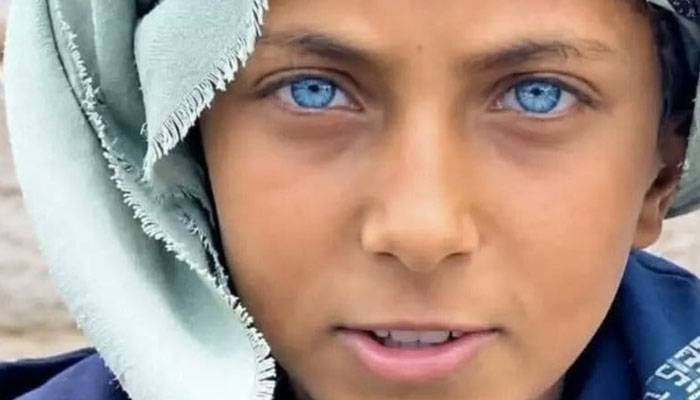 یمن میں نیلی آنکھوں والا 12 سالہ بچہ سوشل میڈیا پر توجہ کا مرکز بن گیا